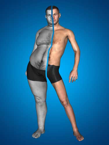ernstig ondergewicht bmi